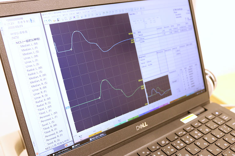 各検査（筋電図・神経伝道検査など）｜川越市のなるかわ内科・脳神経